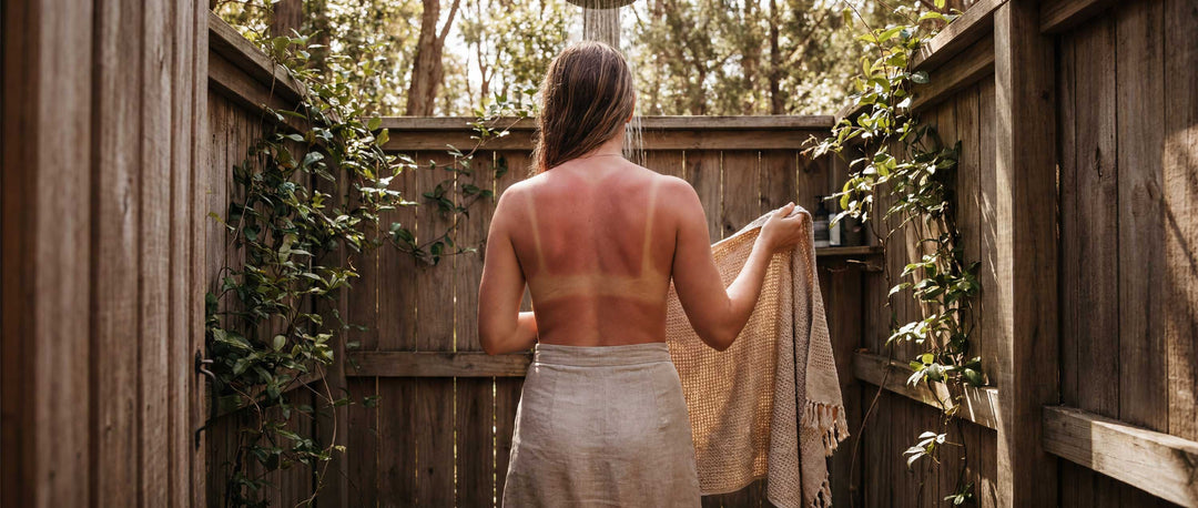 woman with sunburned back showing bathing suit lines outdoor shower